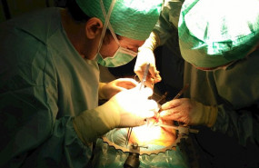ep imagen de recurso una intervencion quirurgica para realizar un trasplante de organo