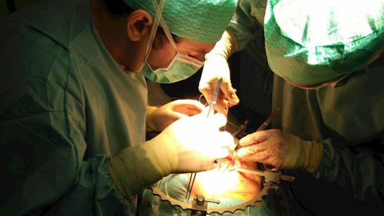 ep imagen de recurso una intervencion quirurgica para realizar un trasplante de organo ep imagen de recurso una intervencion quirurgica para realizar un trasplante de organo