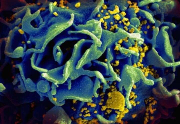 ep imagen microscopica de una celula t infectada con vih