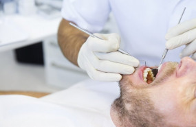 ep dentista boca paciente periodontitis