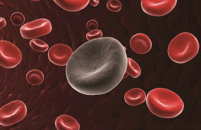 ep las celulas cart se relacionan con la mejora en pacientes de leucemia linfocitica cronica