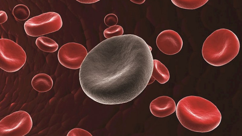 ep las celulas cart se relacionan con la mejora en pacientes de leucemia linfocitica cronica ep las celulas cart se relacionan con la mejora en pacientes de leucemia linfocitica cronica