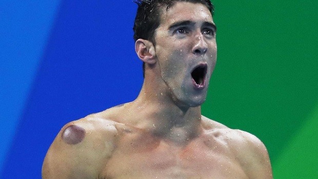 Michael Phelps - ventosaterapia Rio 2016