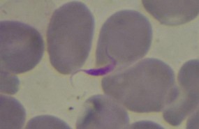 ep parasitochagas