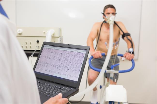 ep rehabilitacion cardiaca
