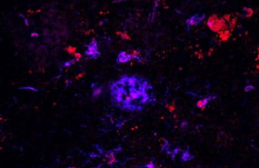 ep los anticuerposapoe rojo se unenlas placasamiloide azul entejido cerebralpersonasenfermedadalzheimer
