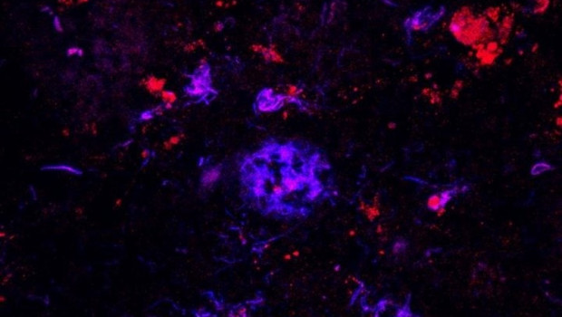 ep los anticuerposapoe rojo se unenlas placasamiloide azul entejido cerebralpersonasenfermedadalzheimer