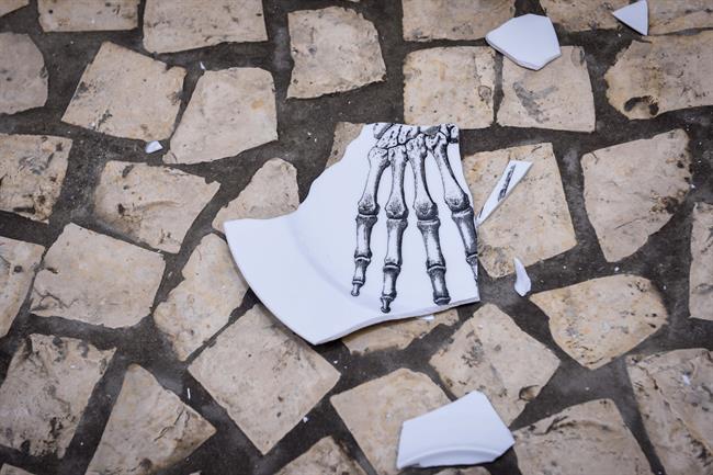 Plato roto por la osteoporosis | FHOEMO/SEIOMM - Archivo ep plato rotola osteoporosis