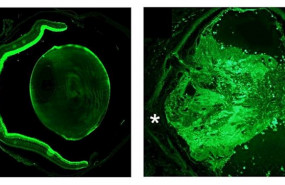 ep la formacion del nervio optico influye en la adaptacion metabolica a la ingesta diaria de