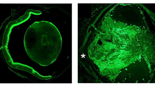 ep la formacion del nervio optico influye en la adaptacion metabolica a la ingesta diaria de
