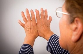 ep artritis reumatoide