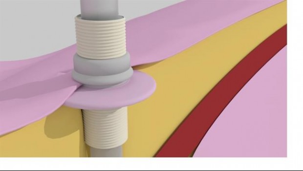 ep collar percutaneo