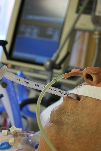 ep paciente conectado a un respirador artificial en la uci