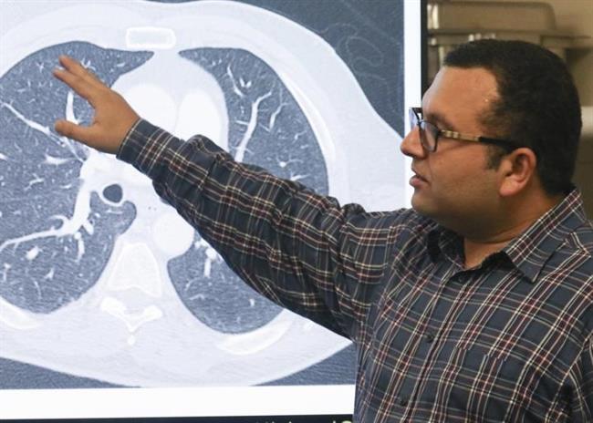 El Profesor Adjunto Ulas Bagci lidera el grupo de ingenieros de la Universidad d | EUREK ep profesor adjunto ulas bagci lideragrupoingenierosla universidad d