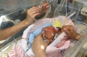 ep bebe prematuro