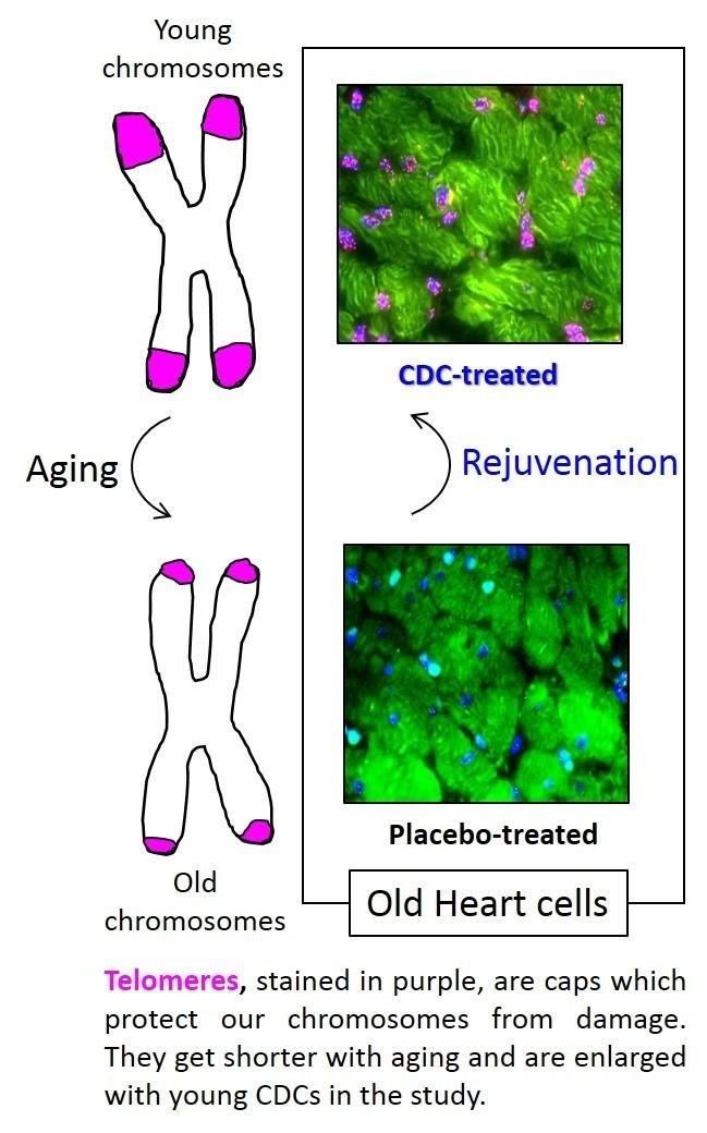 ELÓMEROS, MANCHADOS DE PÚRPURA, SON TAPONES QUE PROTEGEN NUESTROS CROMOSOMAS DEL | CEDARS-SINAI ep elomeros manchadospurpura son taponesprotegencromosomas del