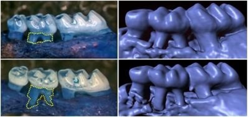 Los ratones sin gustducin desarrollan una pérdida acelerada del hueso que sostiene los dientes y una periodontitis inducida por ligadura más severa, como se muestra en la izquierda y en las imágenes de tomografía computarizada (der) | MONELL CHEMICAL SENSES CENTER ep los ratones sin gustducin desarrollan una perdida acelerada del hueso que sostiene los dientes y