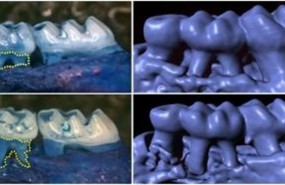 ep los ratones sin gustducin desarrollan una perdida acelerada del hueso que sostiene los dientes y