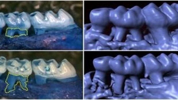 ep los ratones sin gustducin desarrollan una perdida acelerada del hueso que sostiene los dientes y